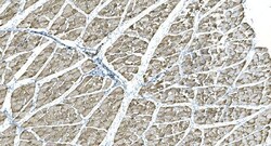 Invitrogen IDH2 Monoclonal Antibody (6B13) 100 &mu;g; Unconjugated:Antibodies,