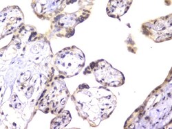 Invitrogen EWSR1 Monoclonal Antibody (4B4) 100 &mu;g; Unconjugated:Antibodies,