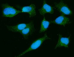 Invitrogen DJ-1 Monoclonal Antibody (4B10) 100 &mu;g; Unconjugated:Antibodies,