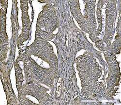 Invitrogen DJ-1 Monoclonal Antibody (4B10) 100 &mu;g; Unconjugated:Antibodies,