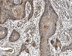 Invitrogen DJ-1 Monoclonal Antibody (4B10) 100 &mu;g; Unconjugated:Antibodies,