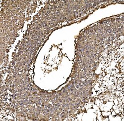 Invitrogen DJ-1 Monoclonal Antibody (4B10) 100 &mu;g; Unconjugated:Antibodies,