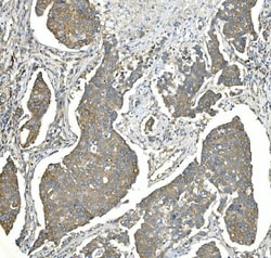 Invitrogen EEF2 Monoclonal Antibody (5F5) 100 &mu;g; Unconjugated:Antibodies,