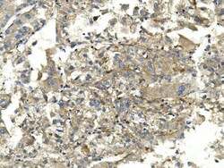 Invitrogen EEF2 Monoclonal Antibody (5F5) 100 &mu;g; Unconjugated:Antibodies,