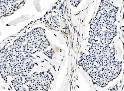 Invitrogen SF1 Monoclonal Antibody (2F5D10) 100 &mu;g; Unconjugated:Antibodies,
