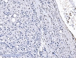 Invitrogen SF1 Monoclonal Antibody (2F5D10) 100 &mu;g; Unconjugated:Antibodies,