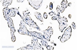 Invitrogen SF1 Monoclonal Antibody (2F5D10) 100 &mu;g; Unconjugated:Antibodies,