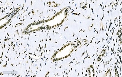 Invitrogen SF1 Monoclonal Antibody (2F5D10) 100 &mu;g; Unconjugated:Antibodies,