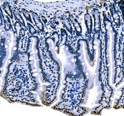 Invitrogen SF1 Monoclonal Antibody (2F5D10) 100 &mu;g; Unconjugated:Antibodies,