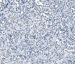 Invitrogen SF1 Monoclonal Antibody (2F5D10) 100 &mu;g; Unconjugated:Antibodies,