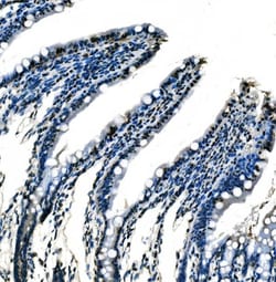 Invitrogen SF1 Monoclonal Antibody (2F5D10) 100 &mu;g; Unconjugated:Antibodies,