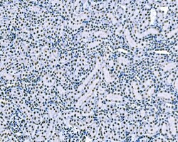 Invitrogen SF1 Monoclonal Antibody (2F5D10) 100 &mu;g; Unconjugated:Antibodies,