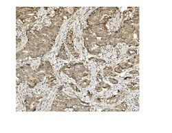 Invitrogen MUT Monoclonal Antibody (2D6) 100 &mu;g; Unconjugated:Antibodies,