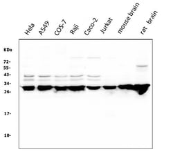 Invitrogen 14-3-3 zeta Monoclonal Antibody (6G5) 100 &mu;g; Unconjugated:Antibodies,