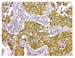 Invitrogen STUB1 Monoclonal Antibody (13I8) 100 &mu;g; Unconjugated:Antibodies,