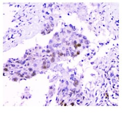 Invitrogen USP7 Monoclonal Antibody (5E2) 100 &mu;g; Unconjugated:Antibodies,