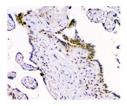 Invitrogen USP7 Monoclonal Antibody (5E2) 100 &mu;g; Unconjugated:Antibodies,