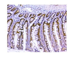 Invitrogen USP7 Monoclonal Antibody (5E2) 100 &mu;g; Unconjugated:Antibodies,
