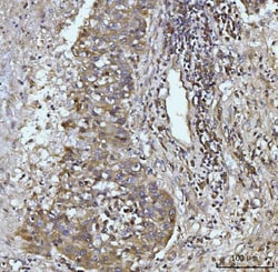 Invitrogen Glutaminase Monoclonal Antibody (9G6) 100 &mu;g; Unconjugated:Antibodies,