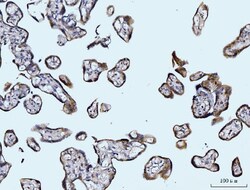 Invitrogen Glutaminase Monoclonal Antibody (9G6) 100 &mu;g; Unconjugated:Antibodies,