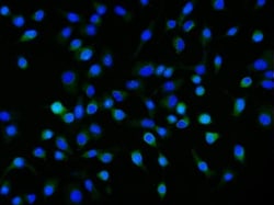Invitrogen Neuropilin 1 Monoclonal Antibody (8G6G7) 100 &mu;g; Unconjugated:Antibodies,