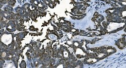 Invitrogen CDC45L Monoclonal Antibody (6H6) 100 &mu;g | Buy Online | Invitrogen&trade; | Fisher Scientific