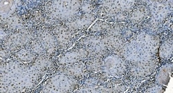 Invitrogen CDC45L Monoclonal Antibody (6H6) 100 &mu;g | Buy Online | Invitrogen&trade; | Fisher Scientific