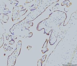 Invitrogen RAB11A Monoclonal Antibody (4H9) 100 &mu;g; Unconjugated:Antibodies,