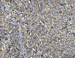 Invitrogen Annexin A1 Monoclonal Antibody (6B7F8) 100 &mu;g; Unconjugated:Antibodies,