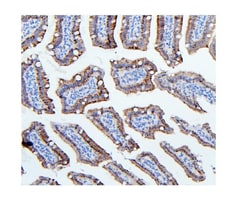 Invitrogen HK1 Monoclonal Antibody (4B7) 100 &mu;g; Unconjugated:Antibodies,