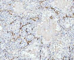 Invitrogen FABP4 Monoclonal Antibody (10E12) 100 &mu;g | Buy Online | Invitrogen&trade; | Fisher Scientific