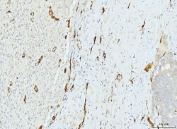Invitrogen FABP4 Monoclonal Antibody (10E12) 100 &mu;g | Buy Online | Invitrogen&trade; | Fisher Scientific