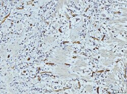 Invitrogen FABP4 Monoclonal Antibody (10E12) 100 &mu;g | Buy Online | Invitrogen&trade; | Fisher Scientific