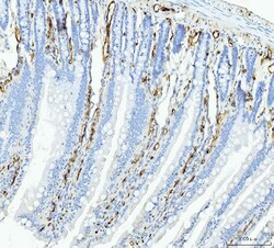 Invitrogen FABP4 Monoclonal Antibody (10E12) 100 &mu;g | Buy Online | Invitrogen&trade; | Fisher Scientific