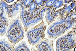 Invitrogen FABP4 Monoclonal Antibody (10E12) 100 &mu;g | Buy Online | Invitrogen&trade; | Fisher Scientific