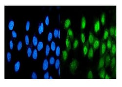 Invitrogen ATF1 Monoclonal Antibody (7F8) 100 &mu;g; Unconjugated:Antibodies,