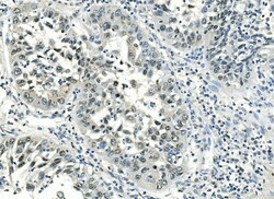 Invitrogen ATF1 Monoclonal Antibody (7F8) 100 &mu;g; Unconjugated:Antibodies,