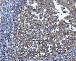 Invitrogen 14-3-3 epsilon Monoclonal Antibody (3G11G2) 100 &mu;g | Buy Online | Invitrogen&trade; | Fisher Scientific