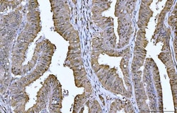 Invitrogen 14-3-3 epsilon Monoclonal Antibody (3G11G2) 100 &mu;g | Buy Online | Invitrogen&trade; | Fisher Scientific
