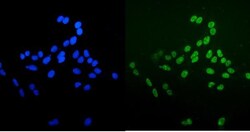 Invitrogen Ku70 Monoclonal Antibody (3D7) 100 &mu;g; Unconjugated:Antibodies,