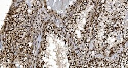 Invitrogen Ku70 Monoclonal Antibody (3D7) 100 &mu;g; Unconjugated:Antibodies,