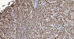 Invitrogen Ku70 Monoclonal Antibody (3D7) 100 &mu;g; Unconjugated:Antibodies,