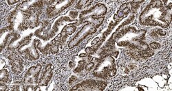 Invitrogen Ku70 Monoclonal Antibody (3D7) 100 &mu;g; Unconjugated:Antibodies,