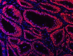 Invitrogen Ku70 Monoclonal Antibody (3D7) 100 &mu;g; Unconjugated:Antibodies,