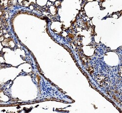 Invitrogen CES1 Monoclonal Antibody (3F10) 100 &mu;g; Unconjugated:Antibodies,