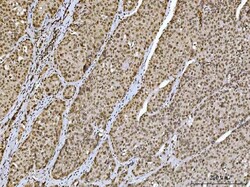 Invitrogen Ataxin 1 Monoclonal Antibody (2B13G8) 100 &mu;g; Unconjugated:Antibodies,