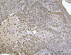 Invitrogen Ataxin 1 Monoclonal Antibody (2B13G8) 100 &mu;g; Unconjugated:Antibodies,