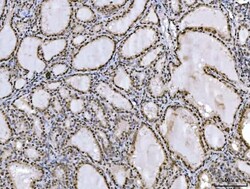 Invitrogen Ataxin 1 Monoclonal Antibody (2B13G8) 100 &mu;g; Unconjugated:Antibodies,