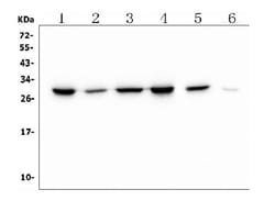Invitrogen PRDX6 Monoclonal Antibody (6I8) 100 &mu;g; Unconjugated:Antibodies,