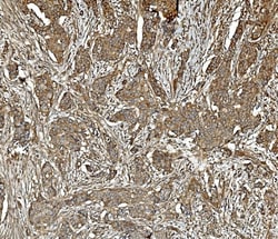 PP2A alpha Monoclonal Antibody (3B6), Invitrogen 100 &mu;g; Unconjugated:Antibodies,
